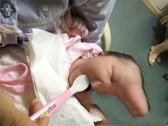 恭喜梅女士助孕成功