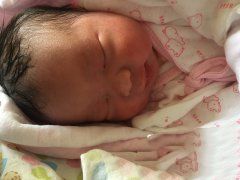 杨女士多囊卵巢在十月弄璋试管成功